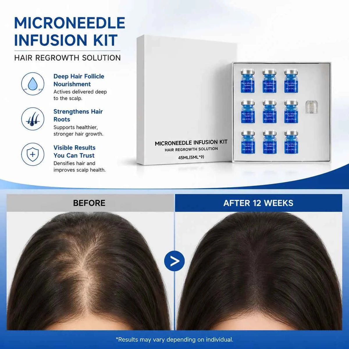 Microagujas para crecimiento del cabello en un kit de Corporación Turística, con pequeñas agujas para estimular el cuero cabelludo.