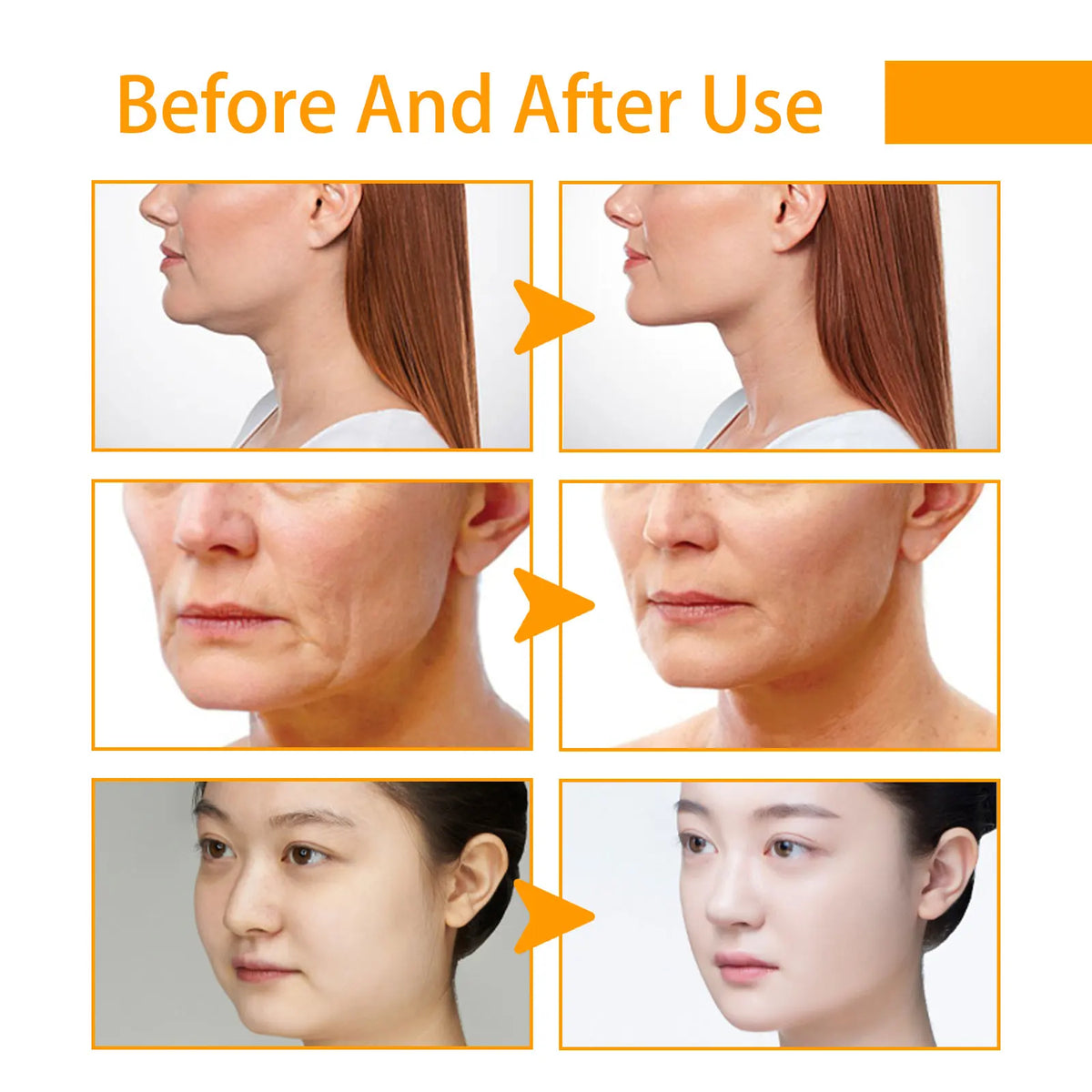 Cream facial rejuvenator with turmeric, antioxidant properties, in a 50g jar from Corporación Turística, designed for skin revitalization.